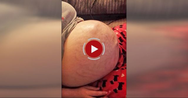 Baby Moving In Belly Kicking And Sticking Legs Out! Pregnancy