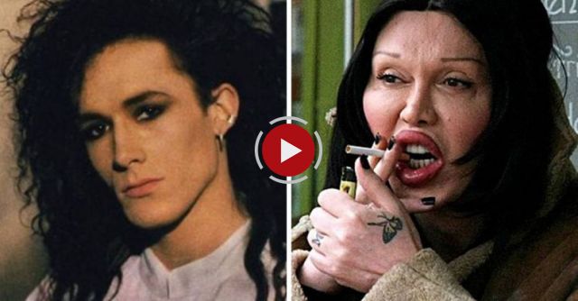 25 CELEBS Plastic Surgery FAILS - Will Shock You !!