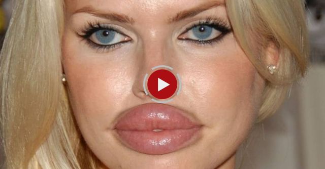 Worst Plastic Surgeries Ever!