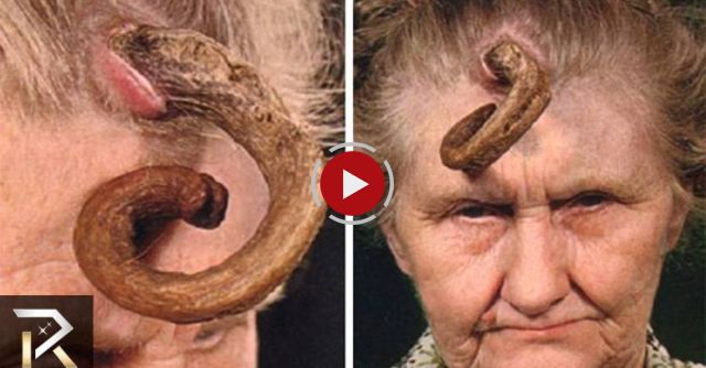 Shocking Medical Conditions You Won't Believe Exist