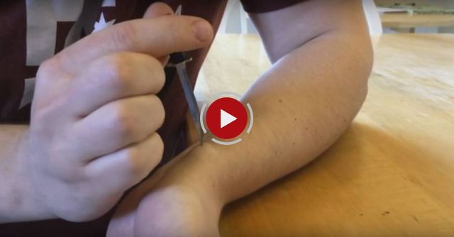 Popping Wrist Cyst With A Mini Samurai Sword