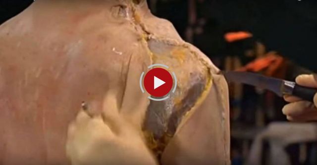 Watch A Doctor Performing Human Dissection In The Most Scientific & FRIGHTENING Video Ever…